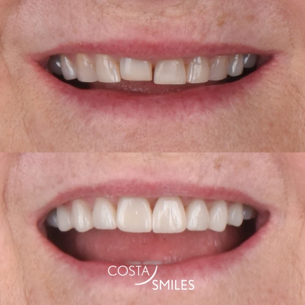 Costa Smiles Dentist